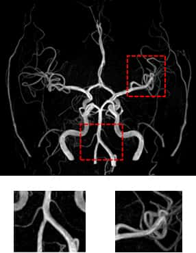 3.0T MRI